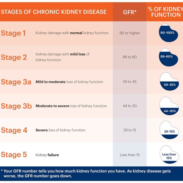 Chronic Kidney Disease Essay Examples