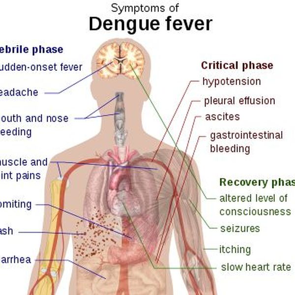 Dengue Fever Basic Points Essay Examples