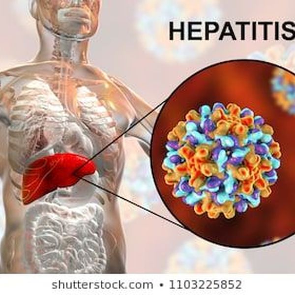 Hepatitis B Essay Examples