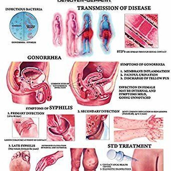 Sexually Transmitted Diseases Essay Examples